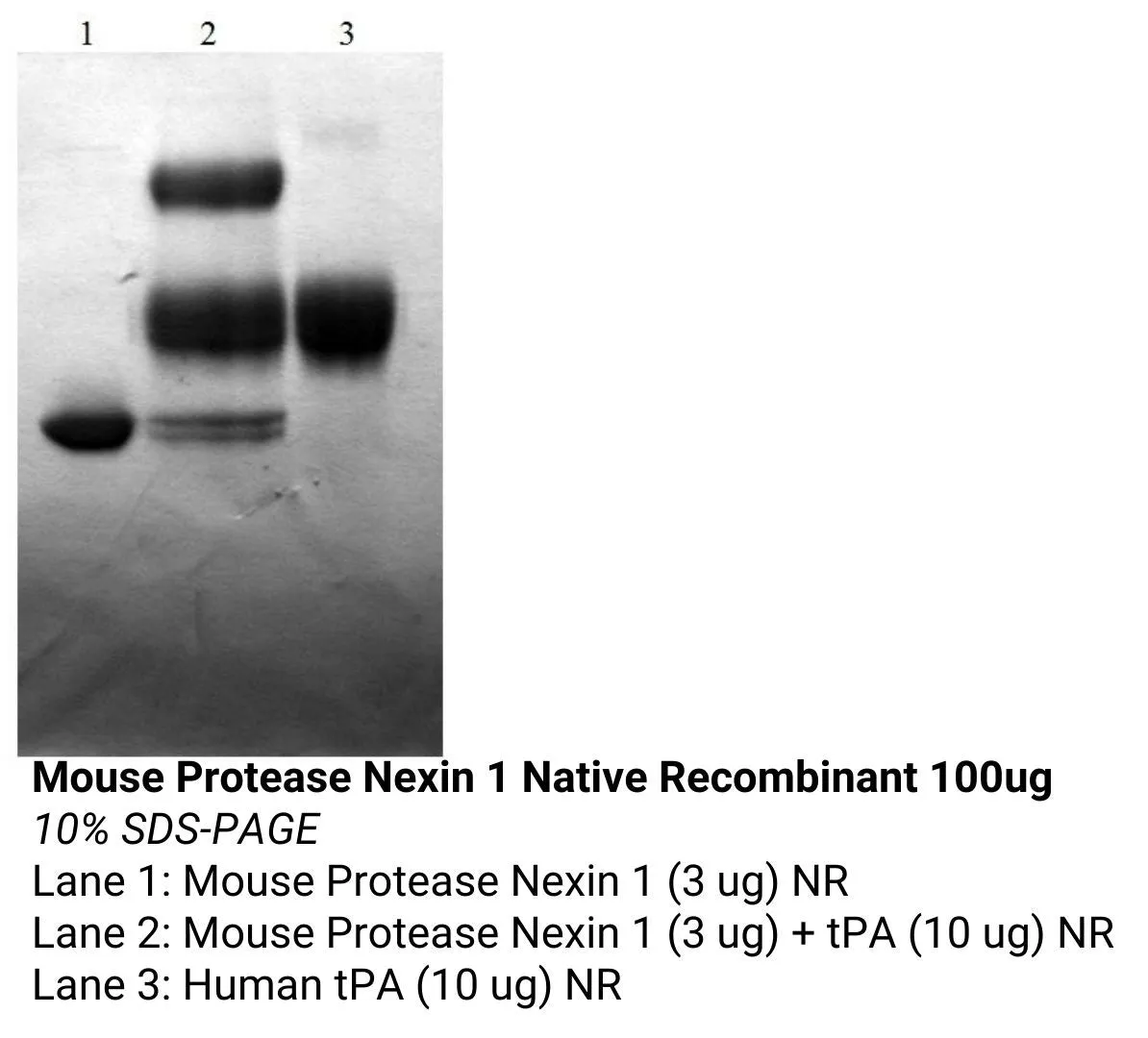 *Mouse Protease Nexin 1 Native Recombinant